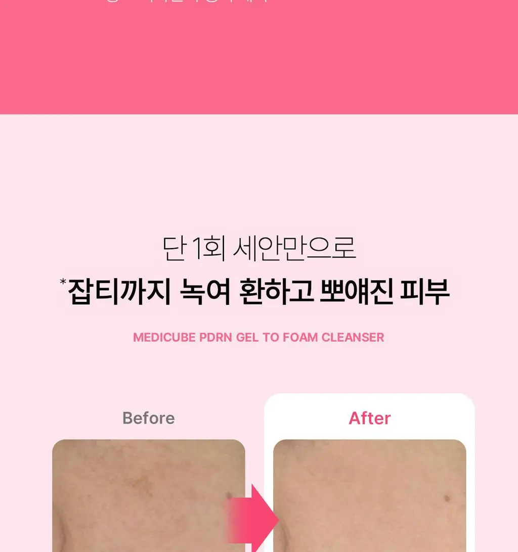 [저자극클렌저] 메디큐브 PDRN 젤투폼 클렌저 200ml 기획(+클렌징브러쉬 증정) 상세페이지 40